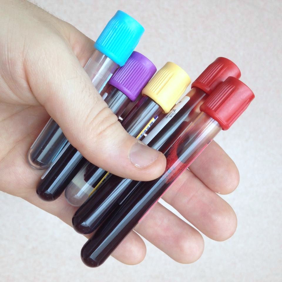 Vacutainer_blood_bottles AskDrManny
