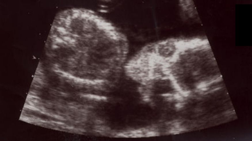 ultrasound2