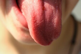 Can Your Tongue Tell You If You’re Sick?